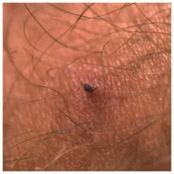 Tire-tique Lifesystems Tick Card White -Randonnée Et Camping 5caa9b000328b9fce2cba62ee690e4a28e83c865 E23LIFSBIV381147 LIFS0202195 901